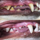 Removedor de Tártaro Ultrassônico Peludita- OFERTA RELÂMPAGO